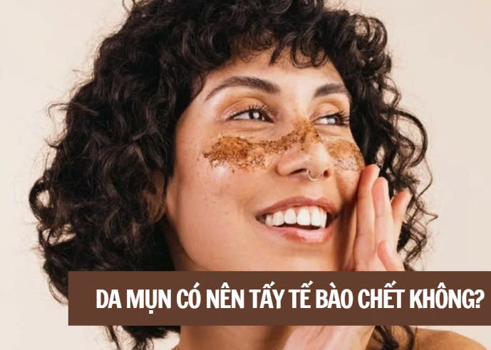 Da mụn có nên tẩy tế bào chết không