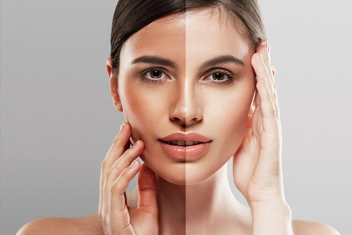 Nguyên nhân là da xỉn màu