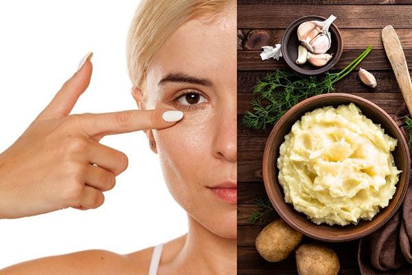 Hướng dẫn chi tiết các công thức trị thâm mắt bằng khoai tây tại nhà