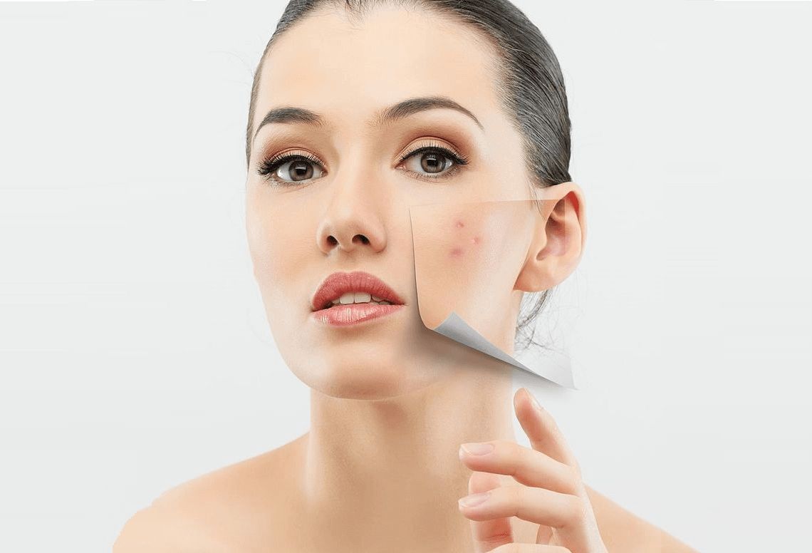Routine chăm sóc da tối giản khi bị kích ứng
